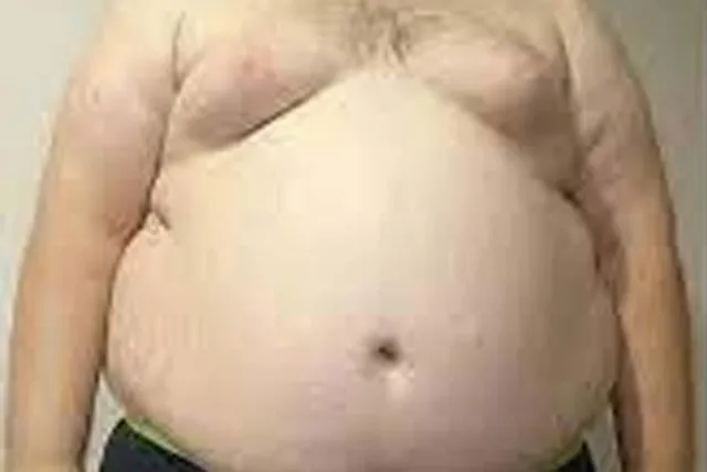 মানসিক রোগের কারণ হতে পারে ওজন বৃদ্ধি