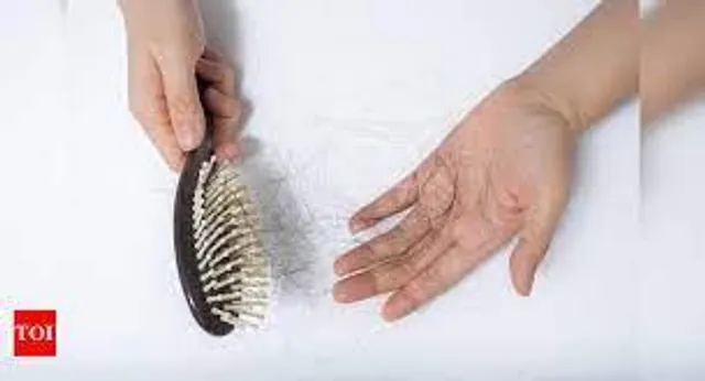 মিষ্টি বেশী খেলে টাক পড়ার সম্ভাবনা অল্প বয়সেই