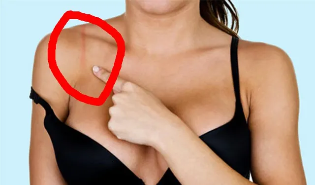 ব্রা থেকে হওয়া দাগ দূর করবেন কীভাবে?