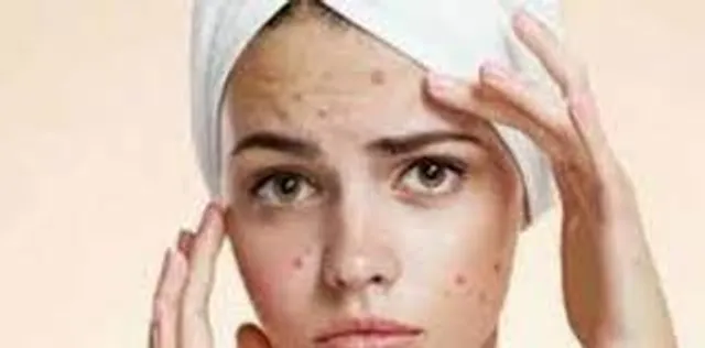 সাবসিশন কি?