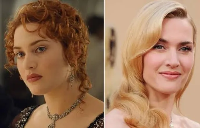 দুর্ঘটনায় আহত হয়ে হাসপাতালে 'টাইটানিক' তারকা কেট