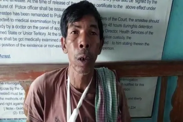 ডেবরায় মদ ব্যবসা করতে বারন করায় কাঠারির কোপ খেলেন এক ব্যাক্তি