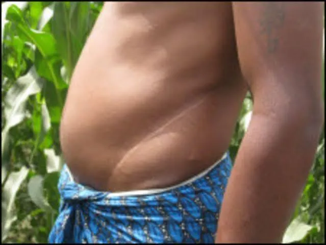 ফের সক্রিয় কিডনি পাচার চক্র, বাড়ছে আতঙ্ক