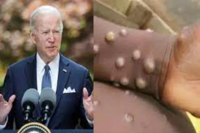 মাঙ্কিপক্স ভাইরাসের ত্রাস কাটিয়ে ওঠার বার্তা বাইডেনের