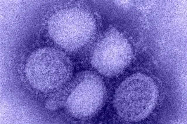 Swine flu panic in South India!