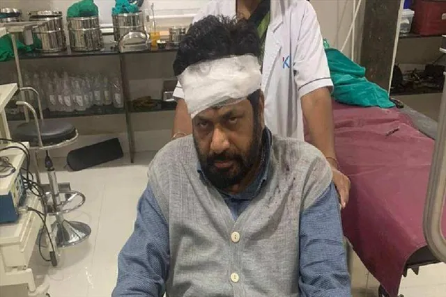 Maharashtra leader Baccu Kadu met with accident