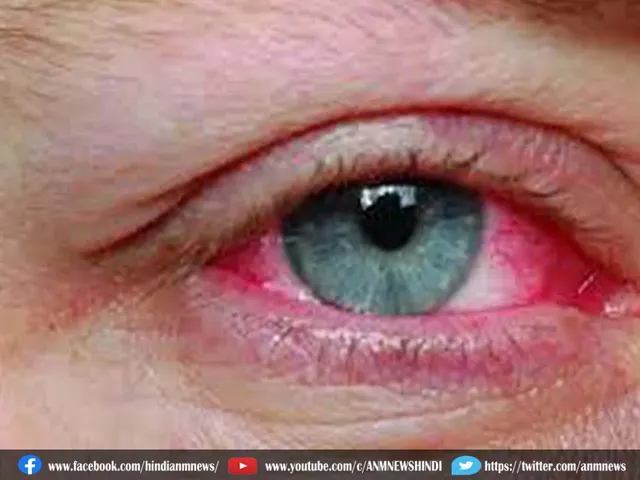 eyeflu67