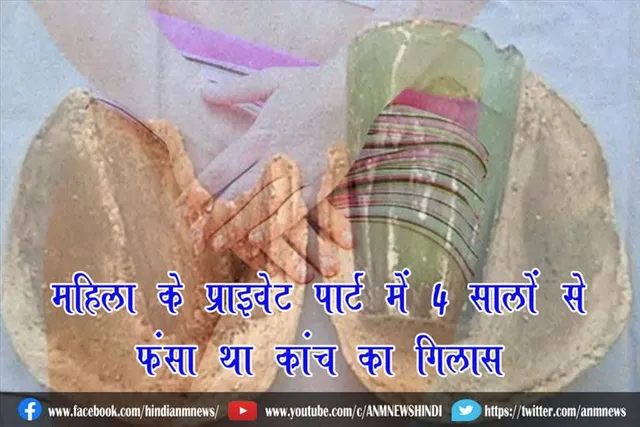 महिला के प्राइवेट पार्ट में 4 सालों से फंसा था ''कांच का गिलास''