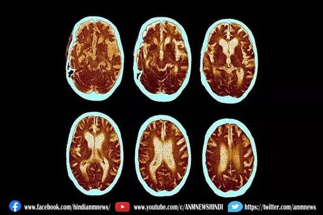 एपस्टीन बार वायरस हर्पीस वायरस परिवार का सदस्य है