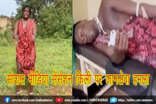 सोशल मीडिया सेंसेशन किली पर जानलेवा हमला