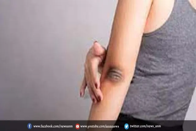 कोहनी के कालापन कैसे दूर करे ?