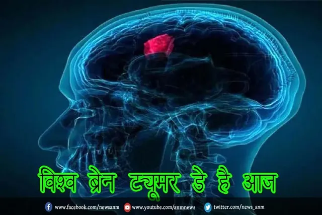 विश्व ब्रेन ट्यूमर डे है आज