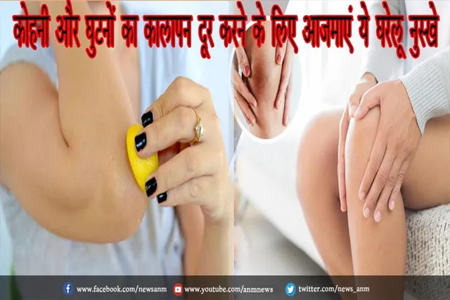 कोहनी और घुटनों का कालापन दूर करने के लिए आजमाएं ये घरेलू नुस्खे