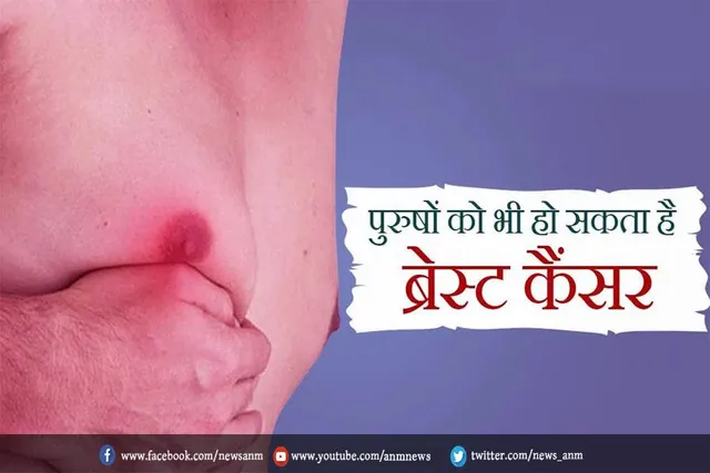 पुरुषों में ब्रेस्ट कैंसर के शरुआती लक्षण