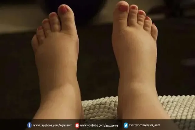 ज्यादा शुगर लेने पर शरीर में नजर आ सकते हैं ये बदलाव