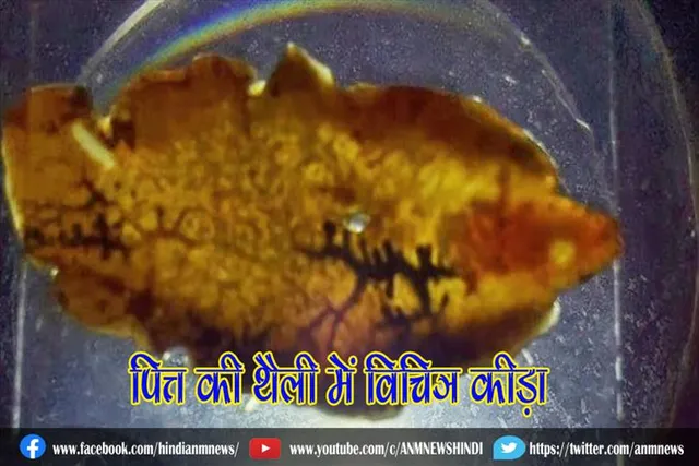 पित्त की थैली में विचित्र कीड़ा