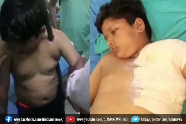 बांस धंसने के कारण घायल बच्चे के हालत में सुधार