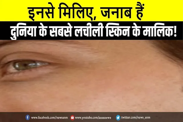 देखे वायरल तस्वीरें: इनसे मिलिए, जनाब हैं सबसे लचीली स्किन के मालिक