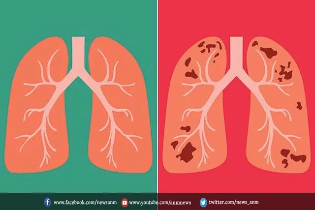 इस साल टीबी मृत्यु दर घटी