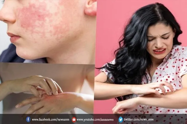 स्किन पर ओमिक्रॉन के लक्षण