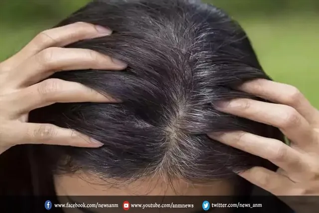 कम उम्र में ही बाल हो रहे हैं सफेद तो अपनाएं ये घरेलू उपाय