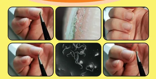 What's inside dirty nails..