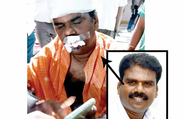 குற்றுயிரான ரிப்போர்ட்டர்! கொலைவெறி காட்டிய ஆளும்கட்சி விசுவாசிகள்!