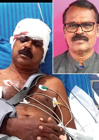 உட்கட்சிப் பகை! உ.பி.மீது கொலைவெறித் தாக்குதல்!