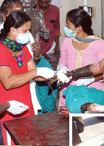 அலட்சியத்தால் எரிந்த 19 உயிர்கள்! கருகிச் சிதைந்த உடல்கள்!- தொடரும் கொடூரம்!