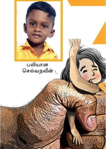 தனியார் பள்ளிகளின் அலட்சியம்! பலிகடாவாகும் பிஞ்சுகள்!