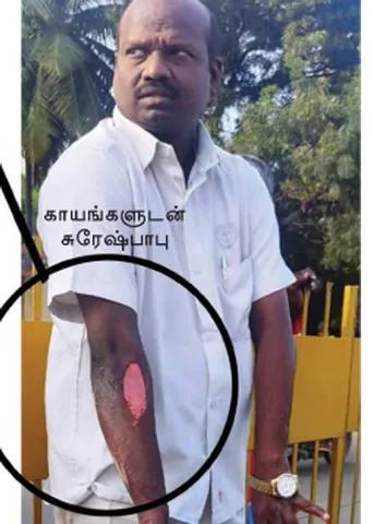 சமூக ஆர்வலர் மீது கொலை முயற்சி! -வேலூர் காவல்துறை அலட்சியம்!