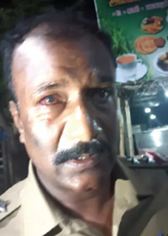 அ.தி.மு.க. வைத்த வெடி! பார்வை பறிபோன காவல் அதிகாரி!