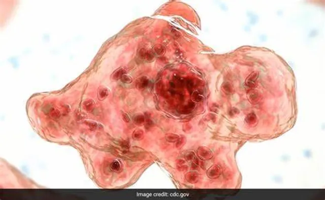  brain-eating amoeba