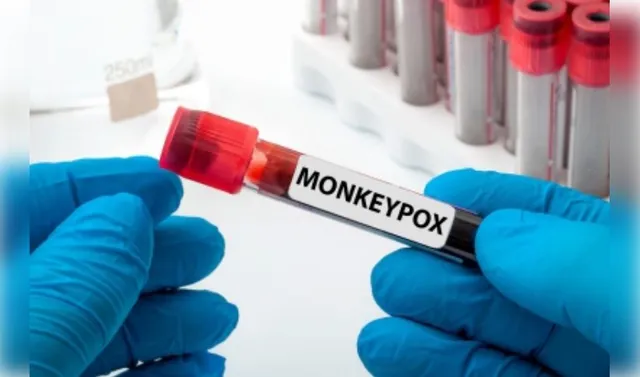 Can Mpox virus spread through air like Covid-19?