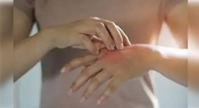 Philippines bans German animal product imports amid foot-and-mouth disease scare