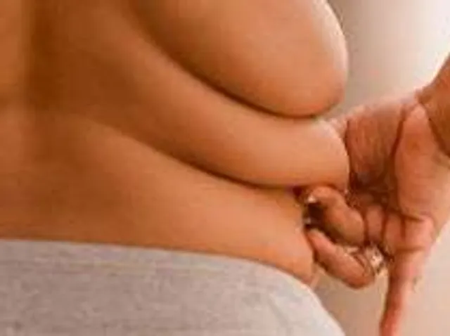 Obesity may contribute to anxiety and cognitive impairment, study suggests