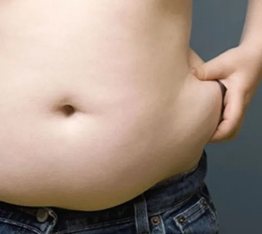 Study finds belly fat may increase psoriasis risk in women