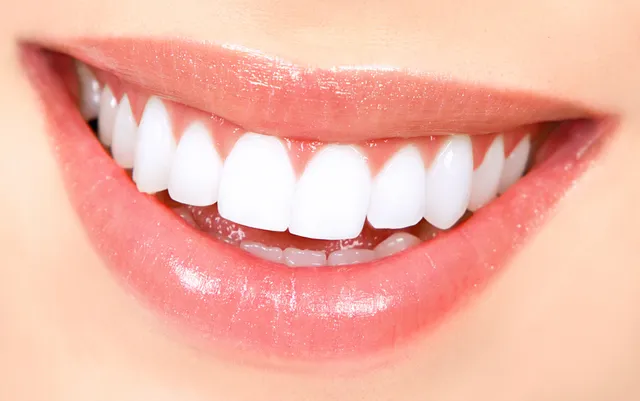 Bad teeth, big problems? Study connects oral health to pain, migraines in women