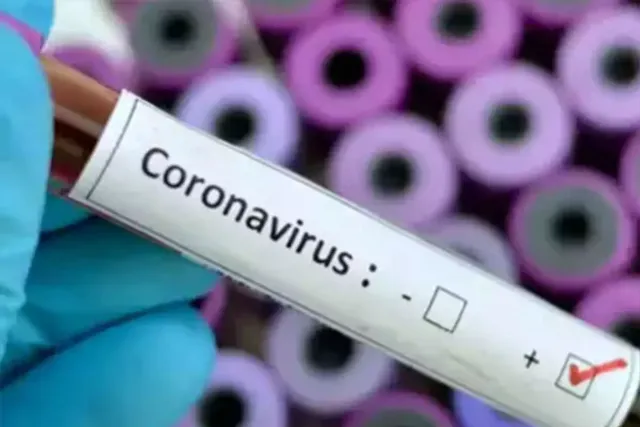 Novel corona virus: No need to panic, but complacence can be lethal
