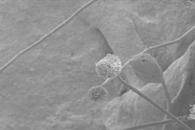 White fungus: Here's what Odisha doctor says