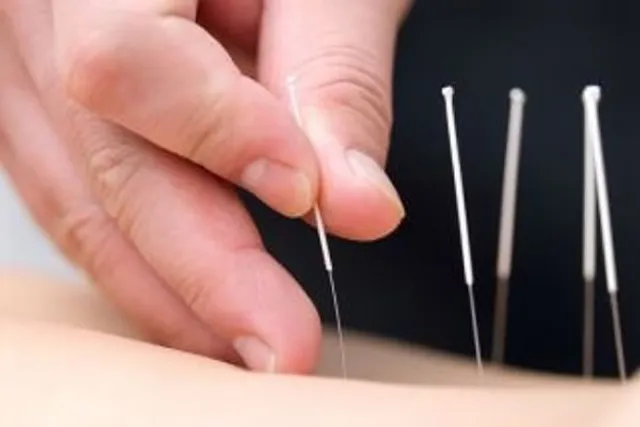 Is Acupuncture key to restoring your body's Thyroid Balance?