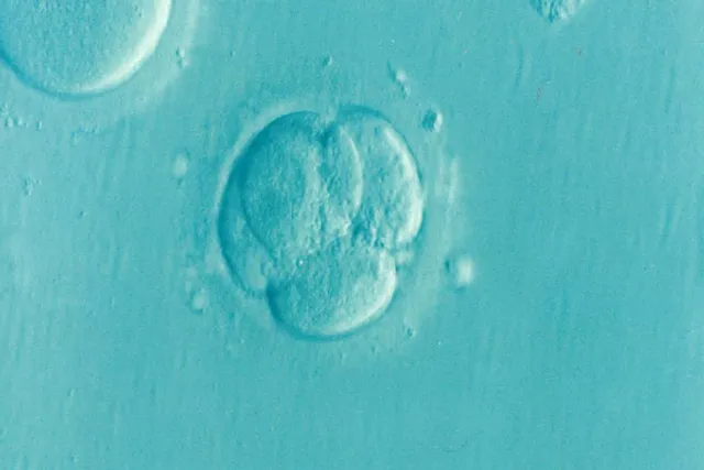 A common cause of infertility, you've probably never heard of