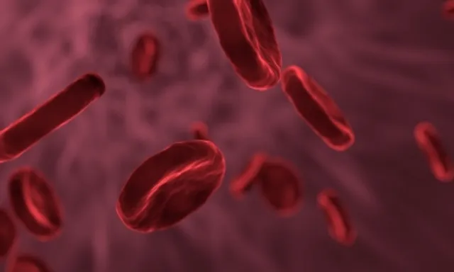 Screening, awareness on stem cell therapy to help fight sickle cell disease