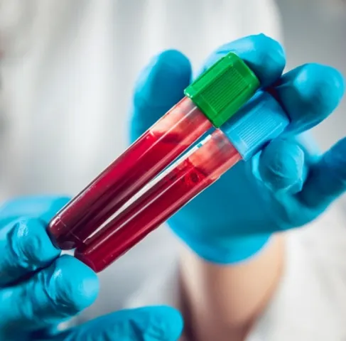 New blood test can spot Alzheimer's risk 15 yrs before symptoms appear