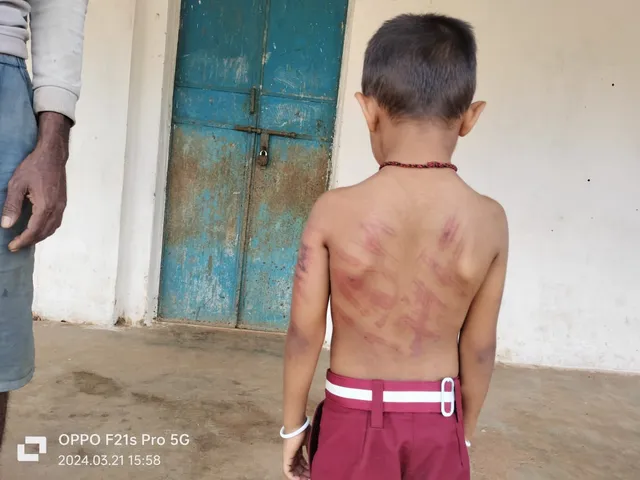 Odisha teacher held for meting out corporal punishment to nursery student