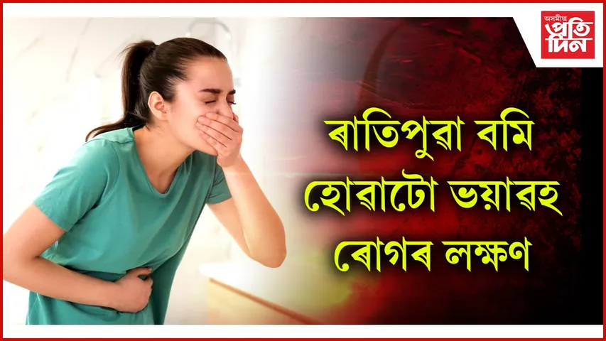 বমি