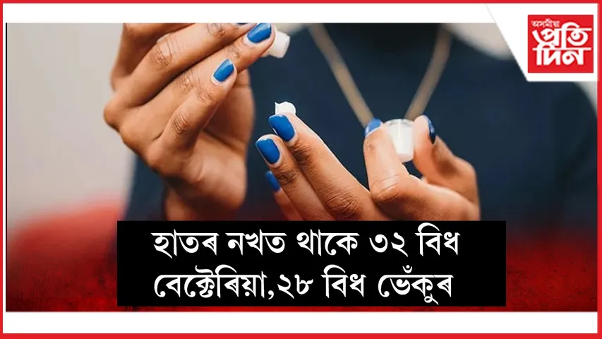 নখ seo