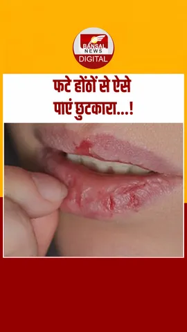 फटे होंठों से ऐसे  THUMB