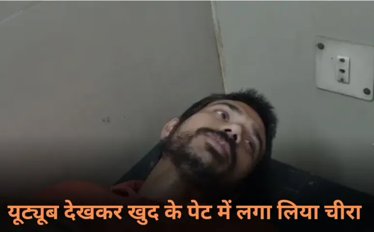 Mathura YouTube Surgery: मथुरा में  यूट्यूब देखकर युवक ने खुद किया ऑपरेशन, सर्जरी कर लगाए 11 टांके, फिर हुआ ये…