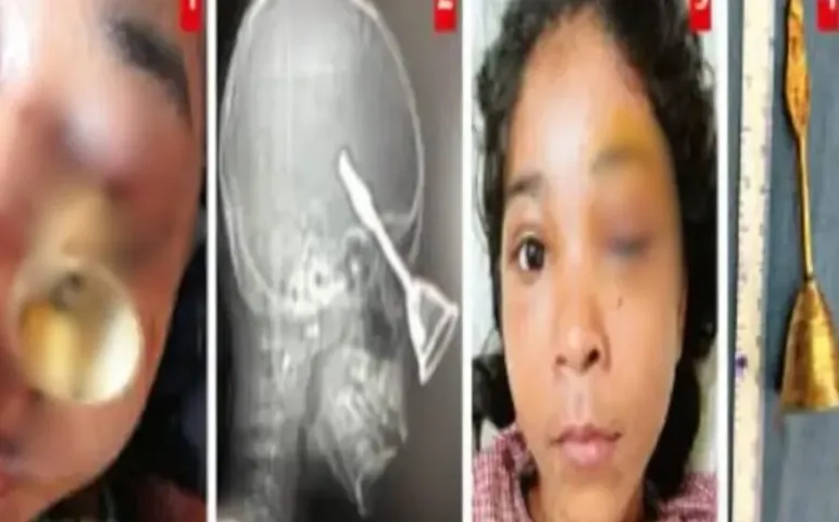 Raipur DKS Hospital Surgery